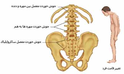 اسپوتدیلیت
