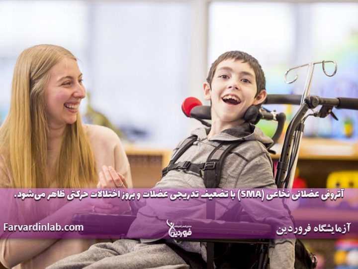 علائم بیماری اس ام ای در بزرگسالان
