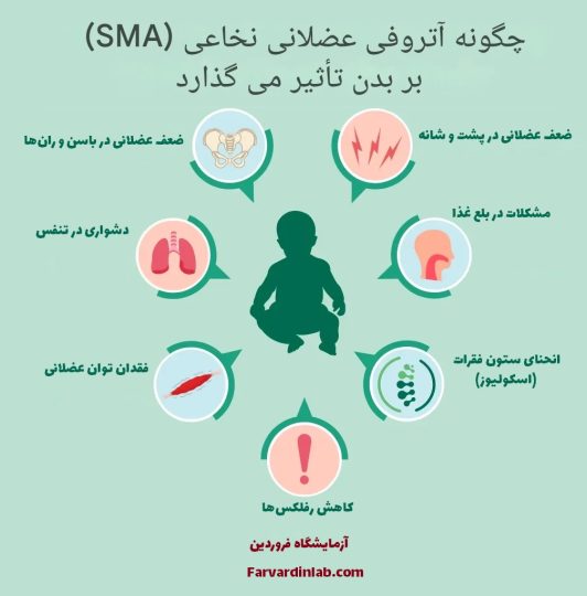 علائم آتروفی عضلانی نخاعی چیست