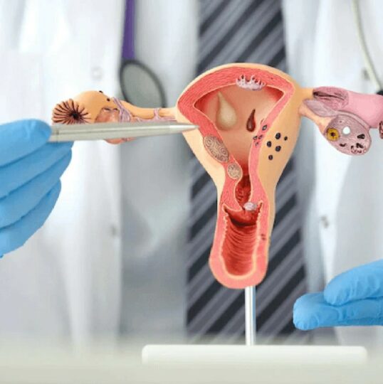 سرطان تخمدان