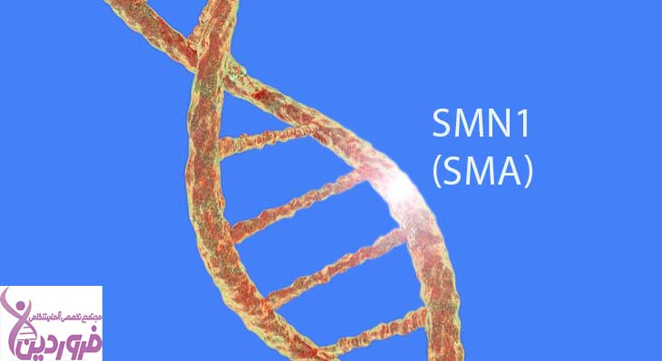 بیماری اس ام ای