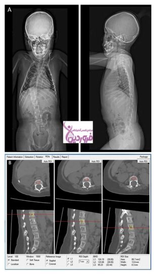 بیمای اس ام ای