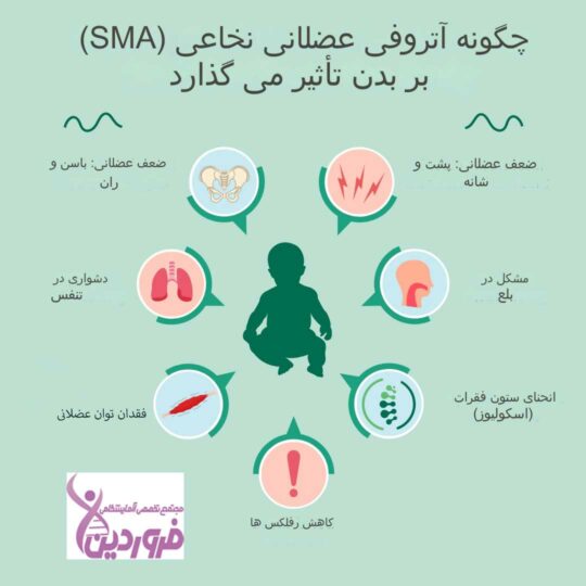 بیمای اس ام ای