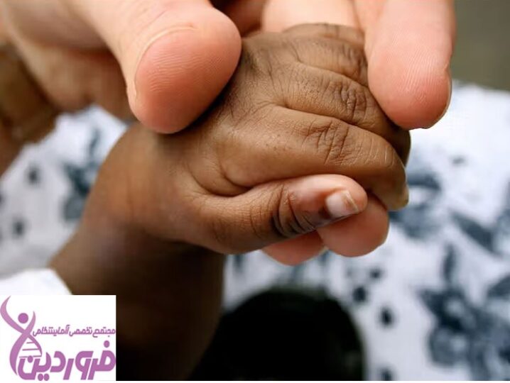 سندرم مارفان