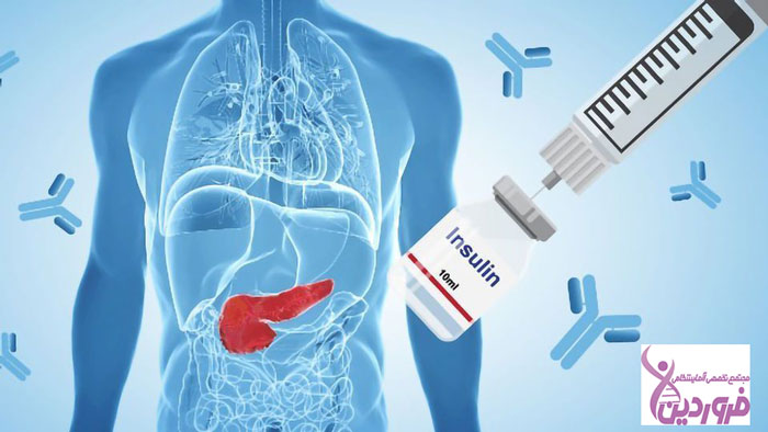 آنتی بادیهای GAD