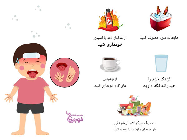 درمان خانگی ویروس بیماری دست، پا و دهان