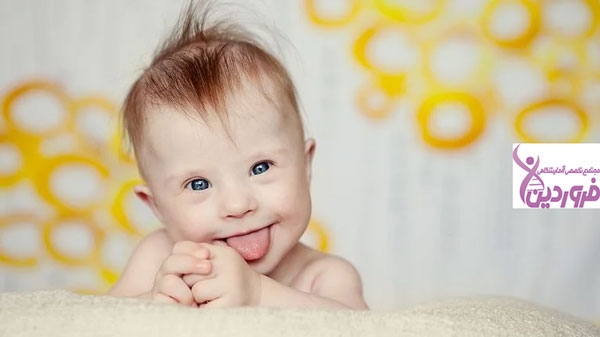 تشخیص سندروم داون در بارداری