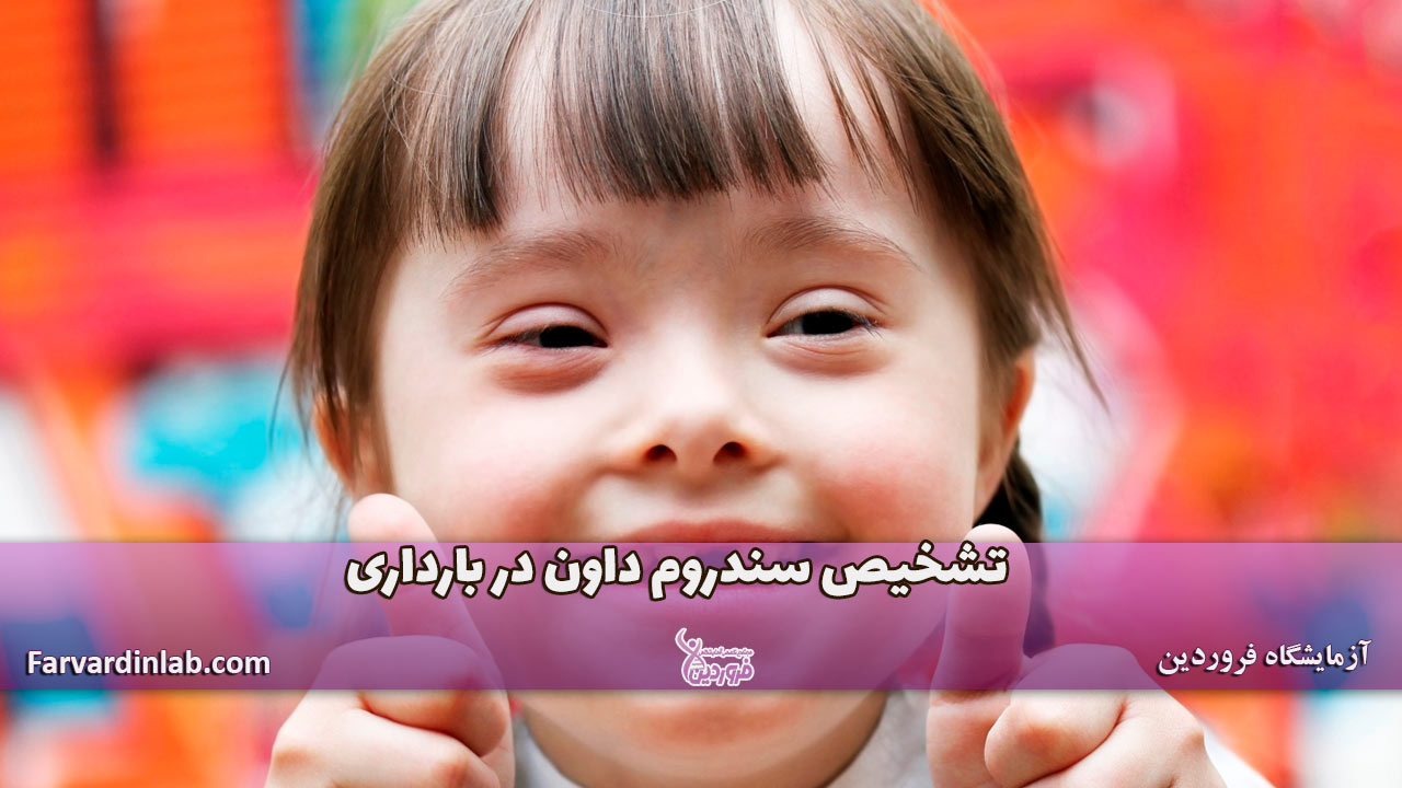 سندرم داون در بارداری