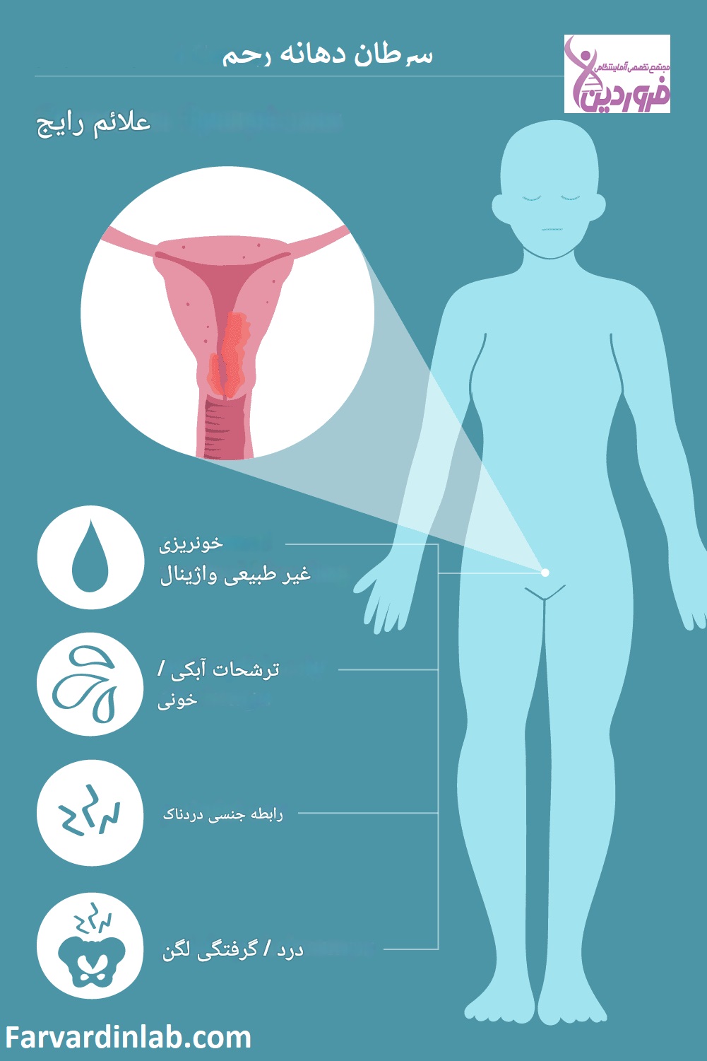 عکس سرطان رحم بدخیم