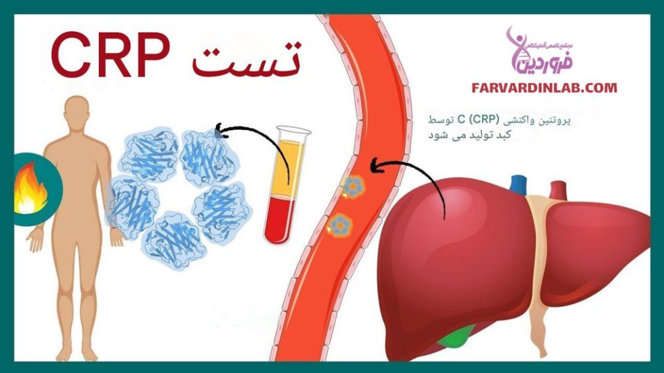 تست crp چیست؟