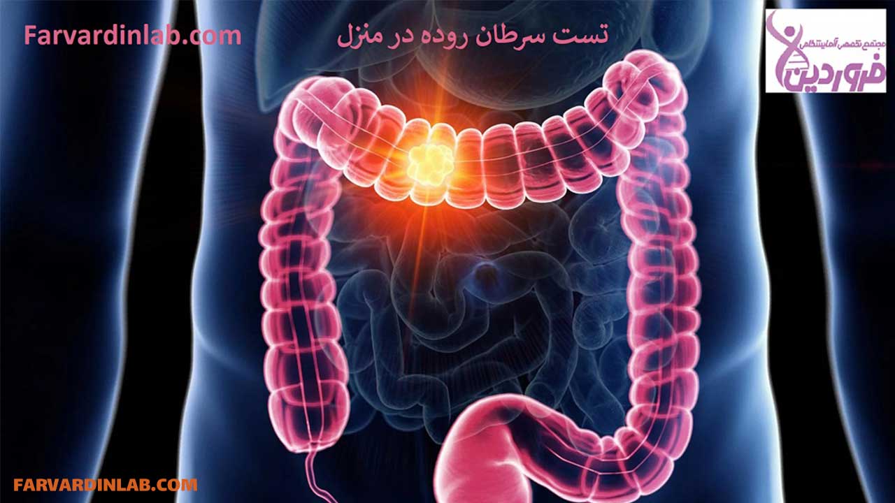 تست سرطان روده در منزل