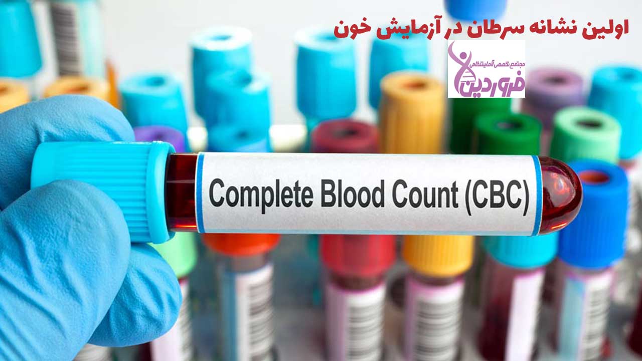 اولین نشانه سرطان در آزمایش خون - آزمایشگاه فروردین