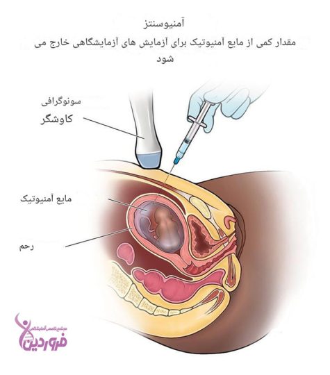 آزمایش ژنتیک بارداری، آزمایشگاه فروردین