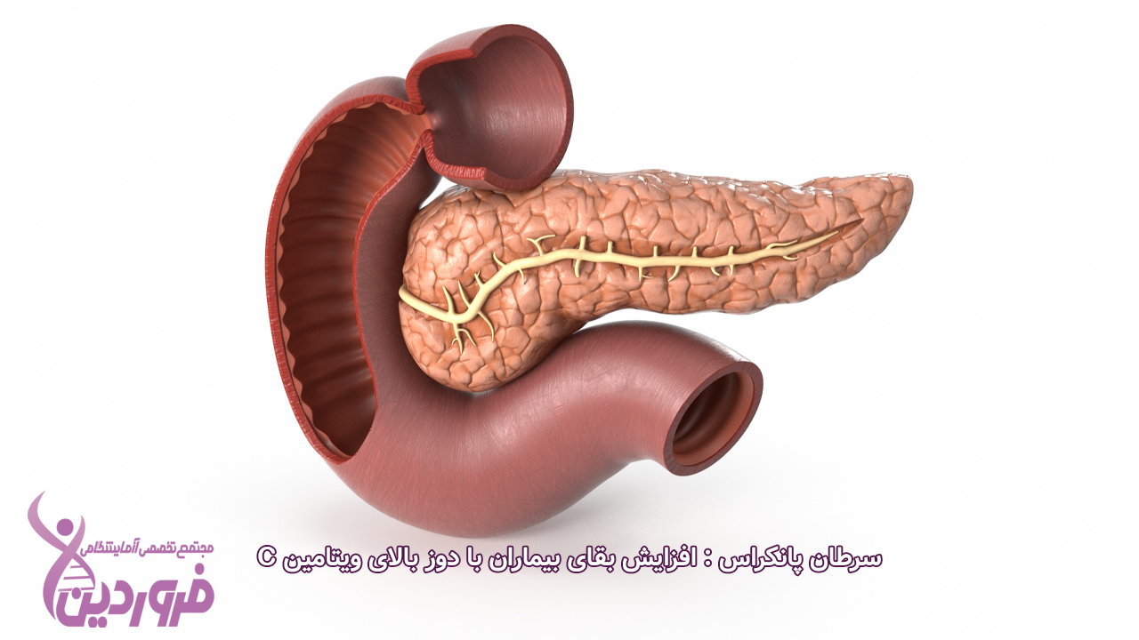 سرطان پانکراس