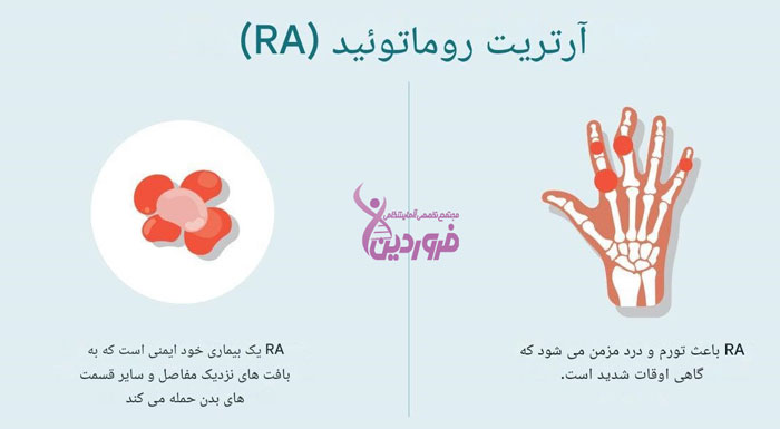 آرتریت روماتوئید چیست