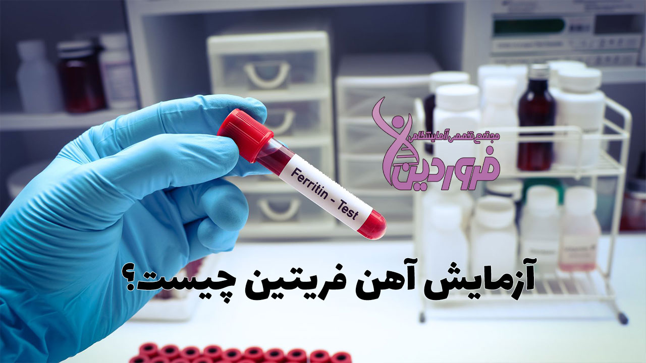 آزمایش آهن فریتین چیست؟