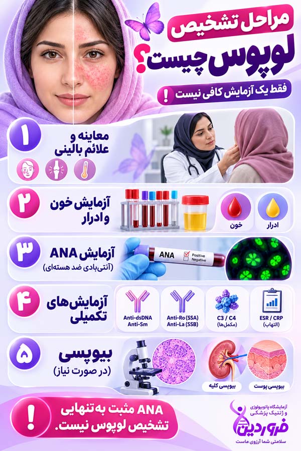 آزمایش لوپوس و علائم آن