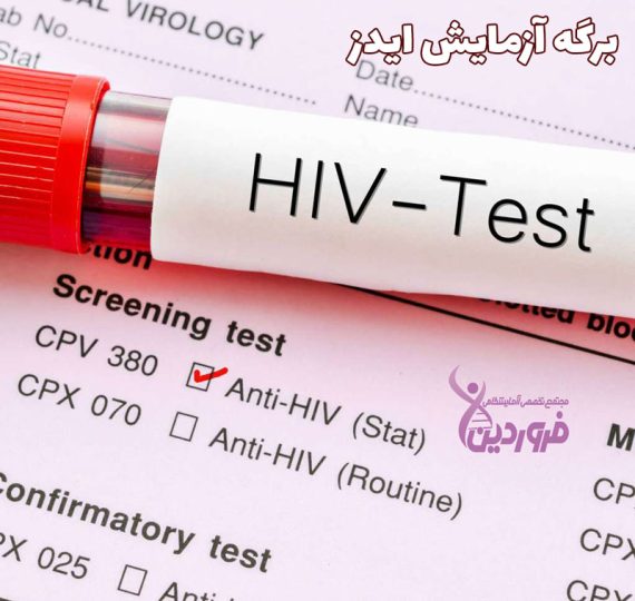 برگه آزمایش ایدز