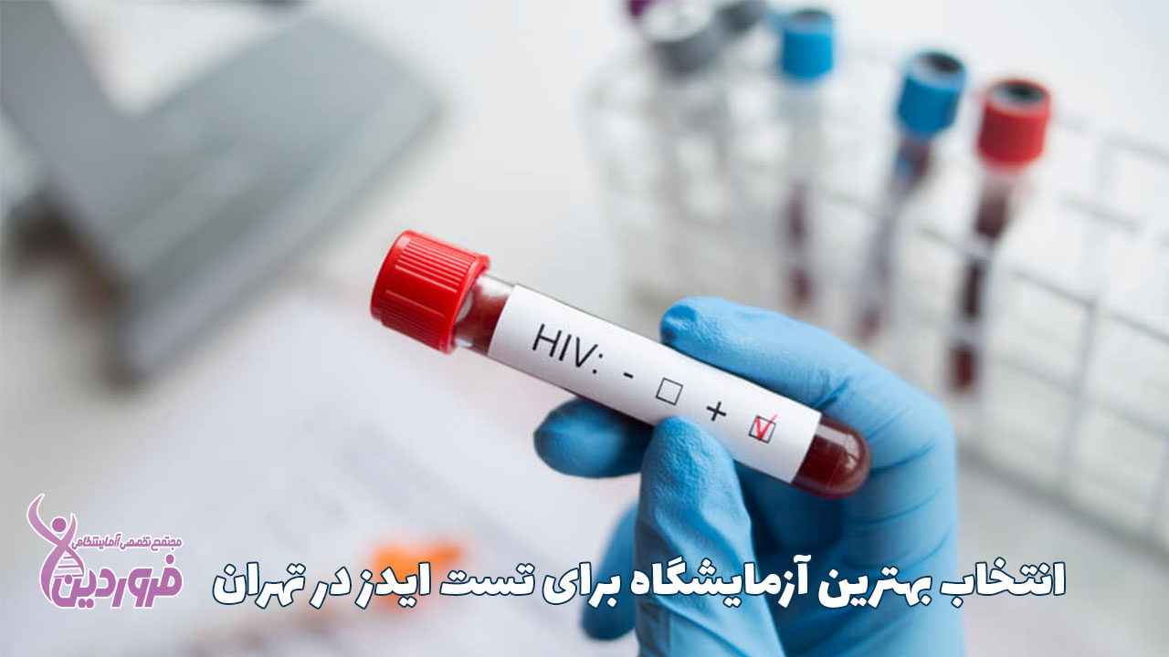 بهترین آزمایشگاه برای تست ایدز