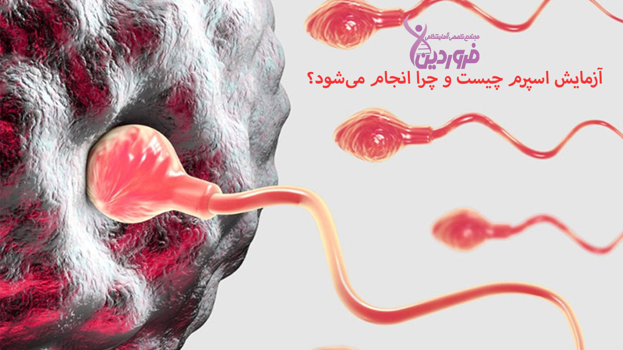 آزمایش اسپرم و آنالیز اسپرم و تست اسپرم چیست