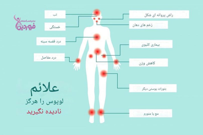 برخی علائم و عوارض لوپوس