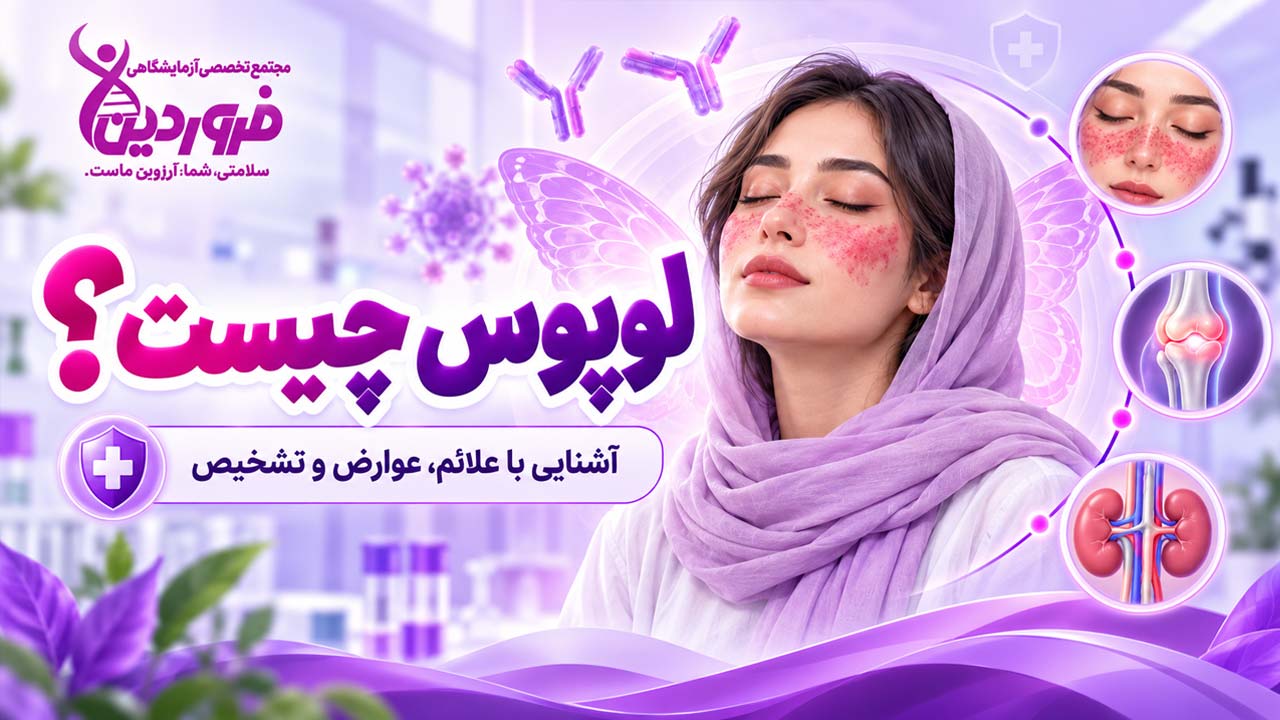 لوپوس چیست