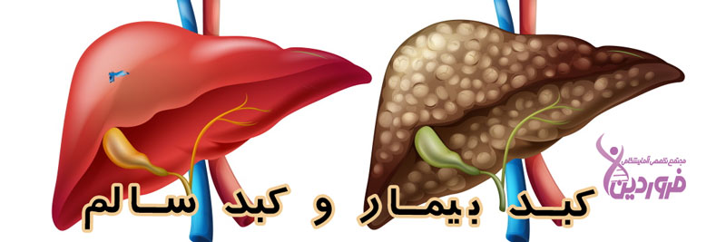 کبد سالم و کبد سرطانی