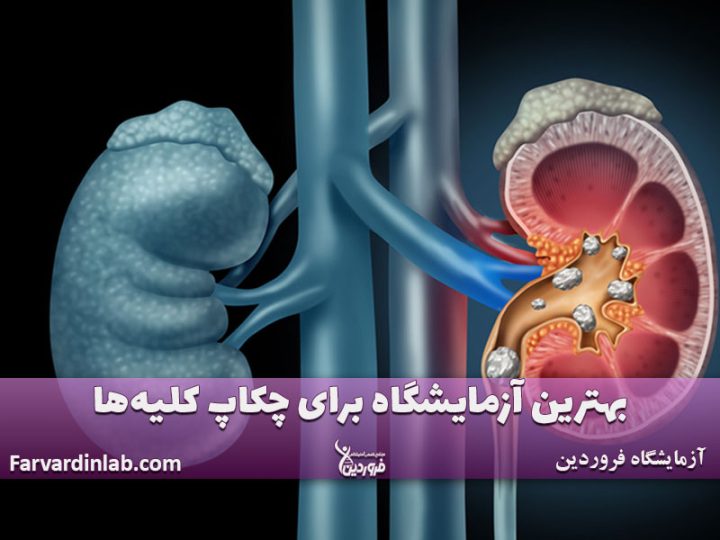 بهترین آزمایشگاه برای چکاپ کلیه