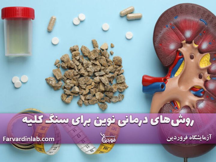 درمان سریع کلیه سنگ ساز