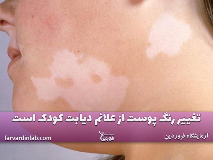 پوست بیماران دیابتی