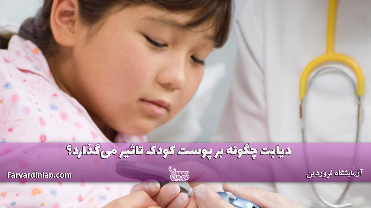 علائم پوستی دیابت در کودکان