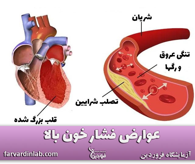 عوارض قلبی