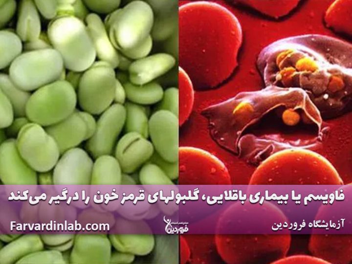 بیماری فاویسم چیست