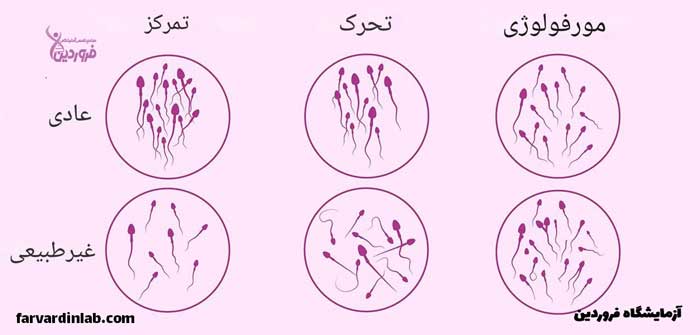 آزمایش منی چطور انجام میشود