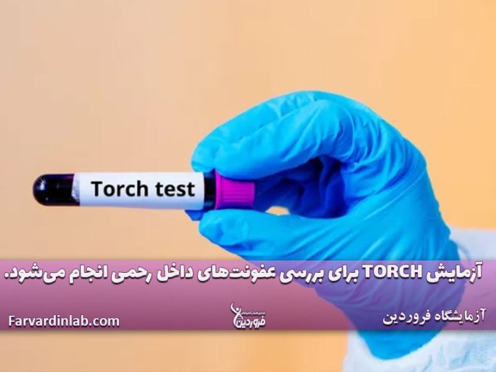 تست TORCH