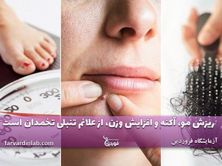 علائم تنبلی تخمدان