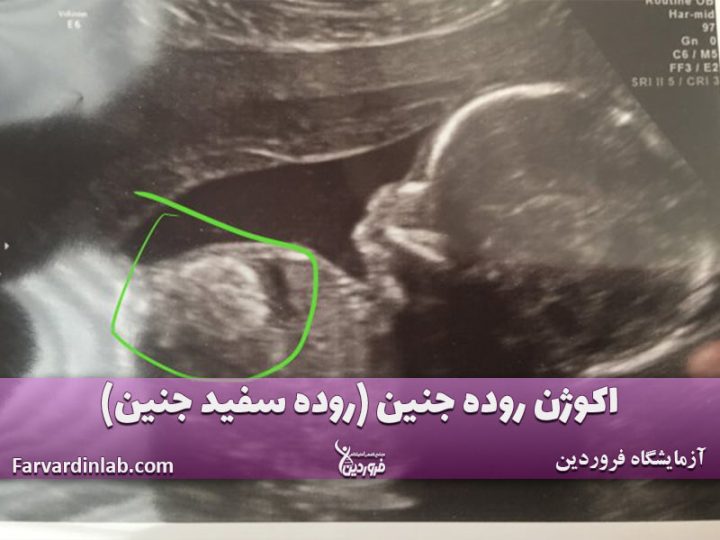 اکوژن روده جنین چیست