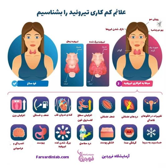 علائم تیروئید کم کار