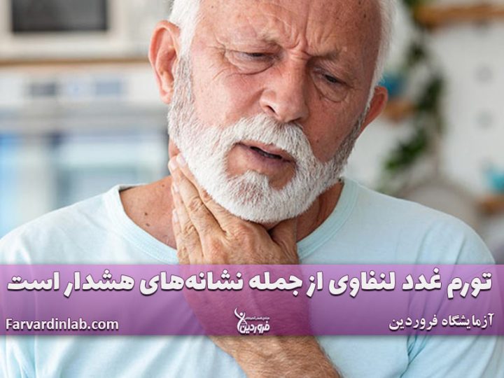 تورم غدد لنفاوی