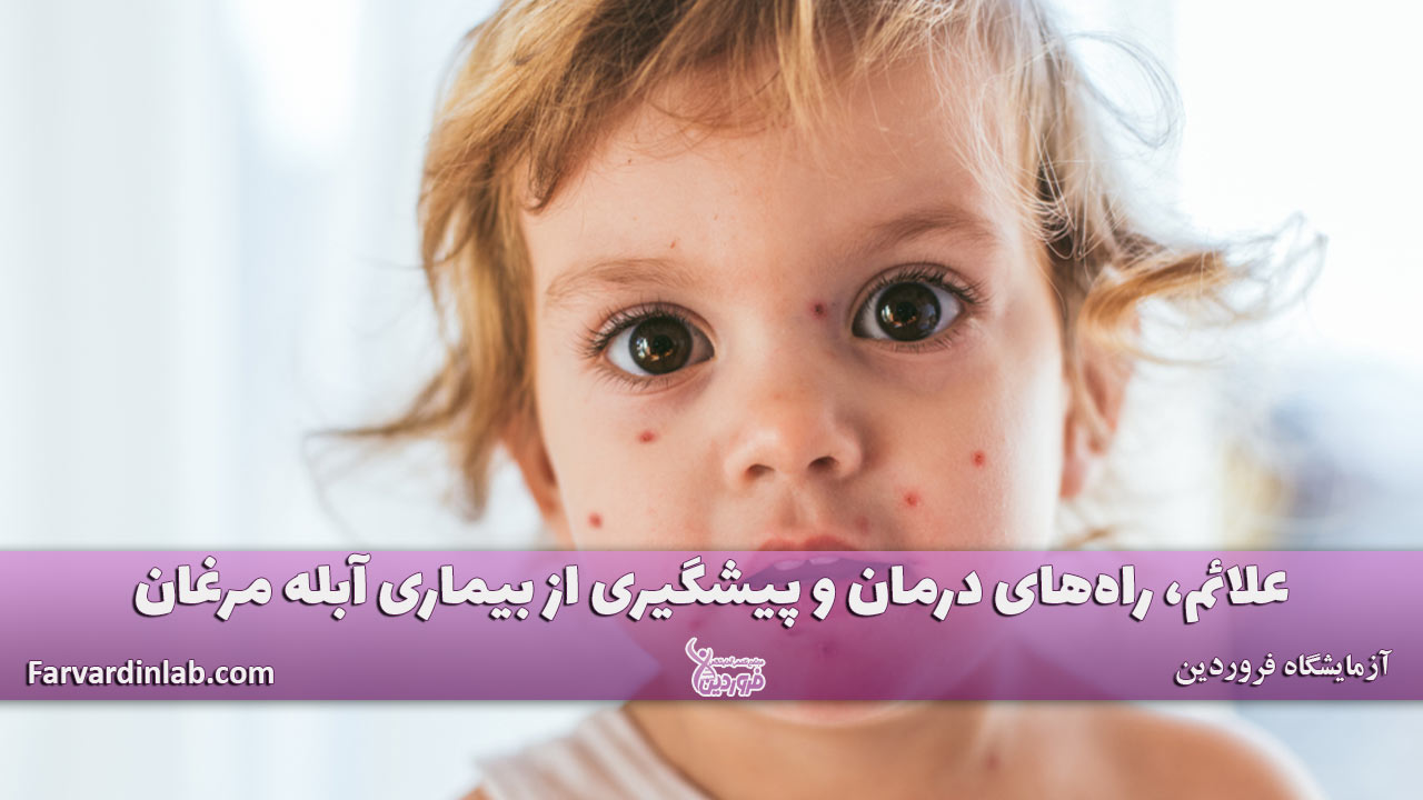 آبله مرغان چیست