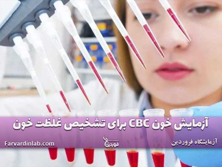 آزمایش غلظت خون