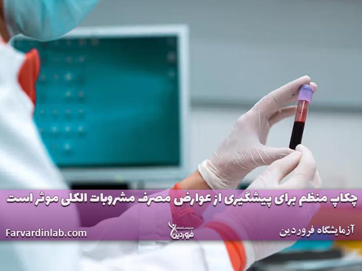 درصد الکل عرق