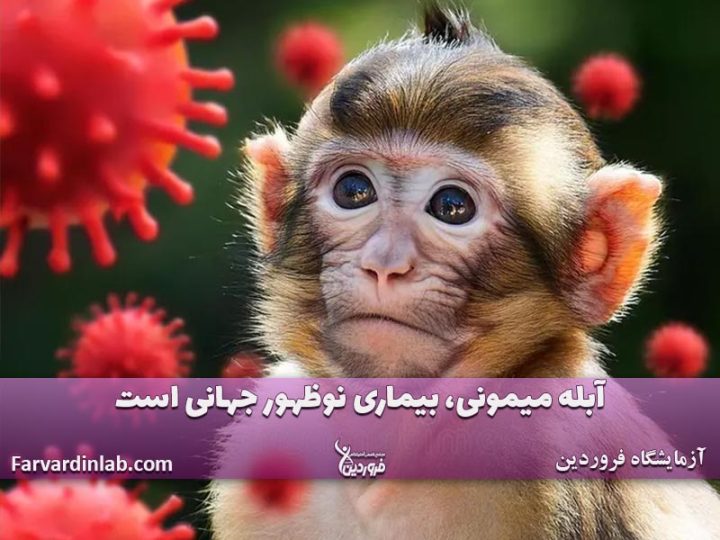 بیماری میمونی