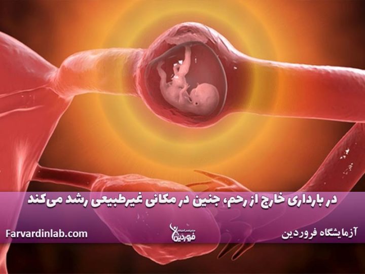 از کجا بفهمیم حاملگی خارج از رحم است