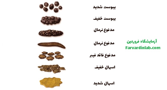 انواع مدفوع و یبوست