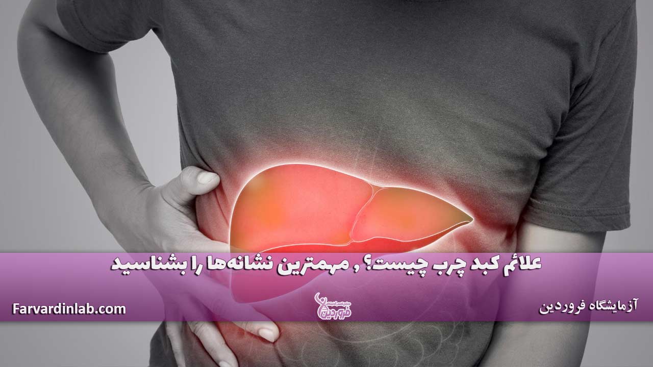 علائم کبد چرب چیست