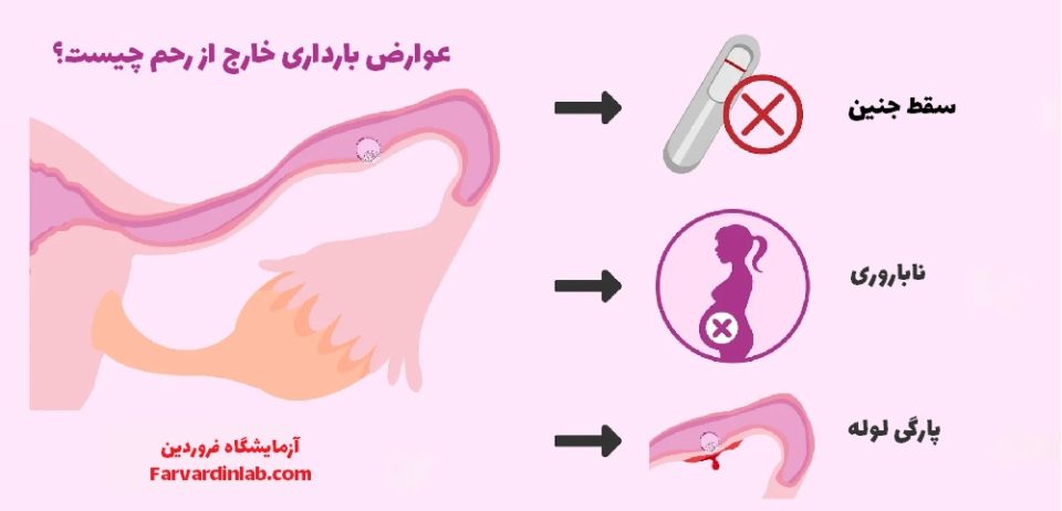 تشخیص حاملگی خارج از رحم با آزمایش خون