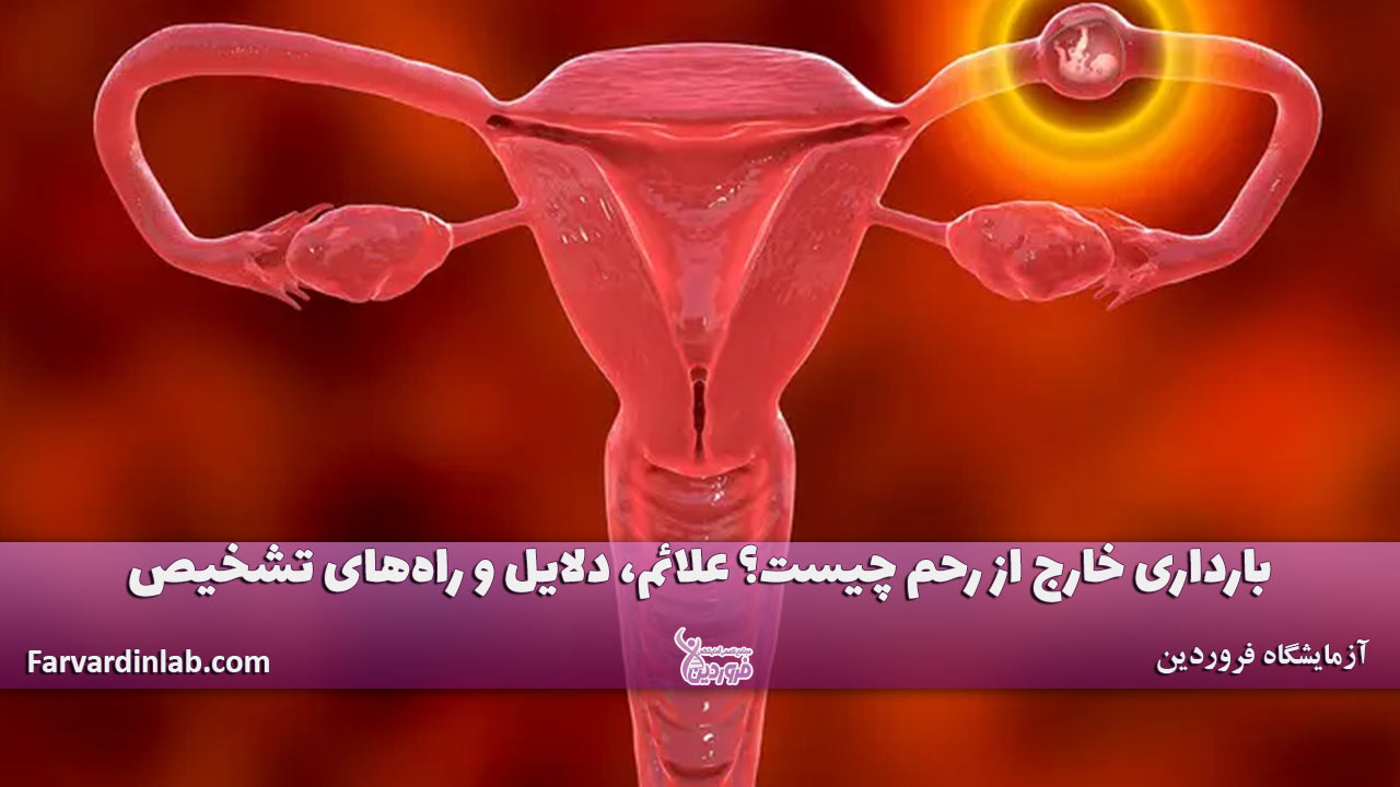 بارداری خارج از رحم چیست