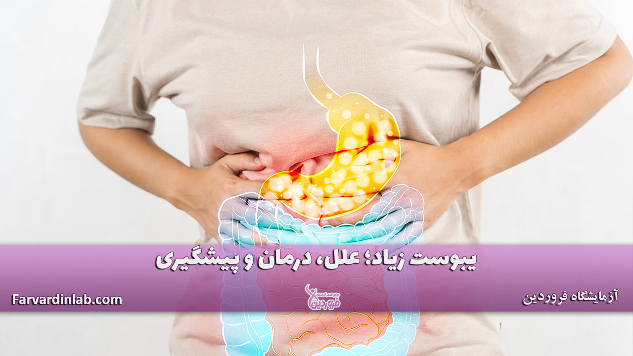 یبوست زیاد نشانه چیست