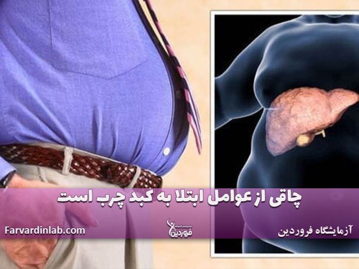 چاقی و بیماریهای کبدی مردان